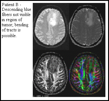 Patient B